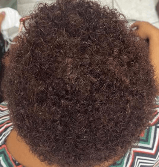 O mesmo topo depois do tratamento, com os cachos cobrindo a área que estava falhada