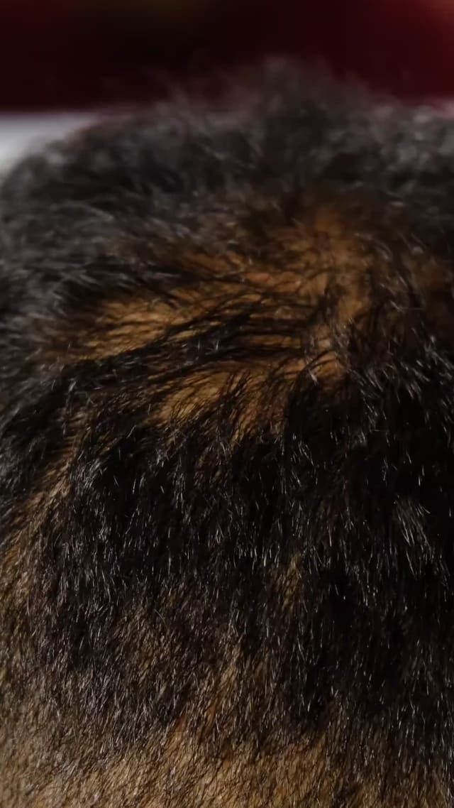 Mãos separando os fios escuros para mostrar o couro cabeludo de perto